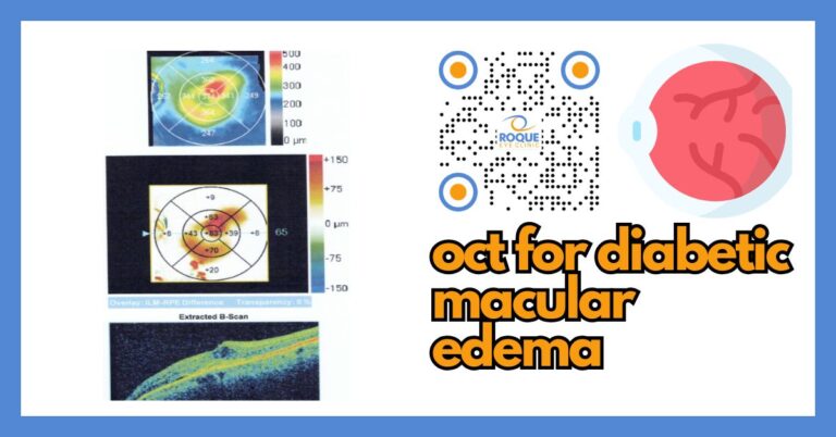 OCT for Diabetic Macular Edema: What the Scan Shows and Why It Matters