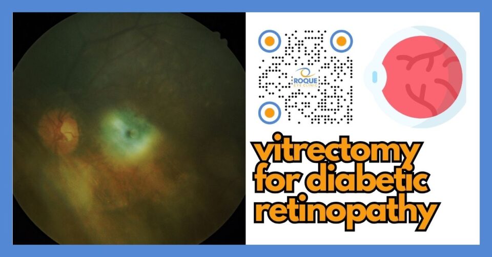 Educational infographic describing vitrectomy for diabetic retinopathy, including common indications (vitreous hemorrhage, traction), key steps of surgery, recovery timeline, and gas bubble travel precautions.