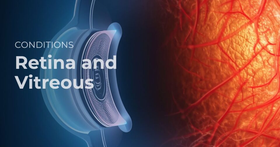 Stylized medical illustration representing the retina and vitreous at the back of the eye